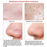 VisiClear ProPurge: Visible Camera Blackhead Remover & Pore Cleaner