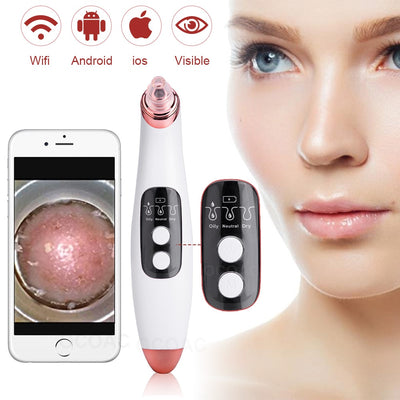 VisiClear ProPurge: Visible Camera Blackhead Remover & Pore Cleaner