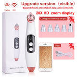 VisiClear ProPurge: Visible Camera Blackhead Remover & Pore Cleaner