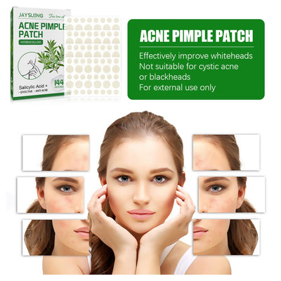 Acne Pimple Patches